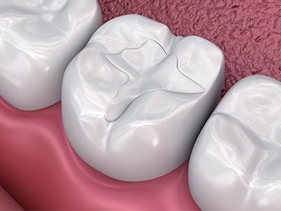 Cosmetic Dental Office in Oakville ON