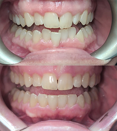 Smile Park Dental | Dental Fillings, Periodontal Treatment and Oral Exams