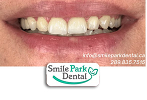 Family Dentist in Oakville ON