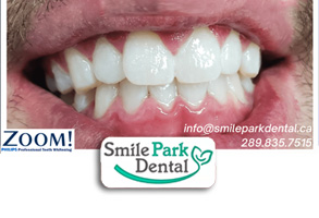 Oakville ON Cosmetic Dentist