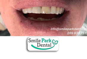 Family Dentist in Oakville ON