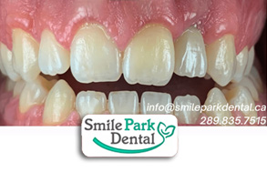 Oakville ON Cosmetic Dentist