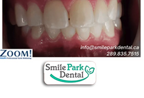 Family Dentist in Oakville ON