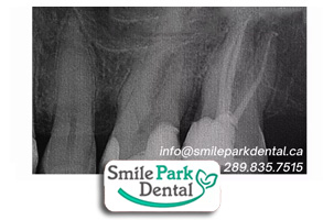 Cosmetic Dental Office in Oakville ON