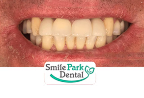 Oakville ON Cosmetic Dentist