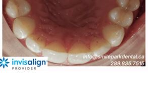 Cosmetic Dental Office in Oakville ON