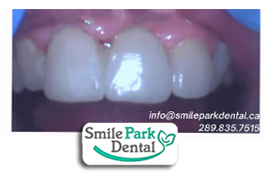 Dentist in Oakville ON