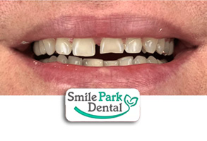 Invisalign Oakville ON