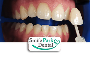 Invisalign Oakville ON