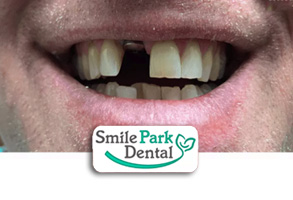 Cosmetic Dental Office in Oakville ON