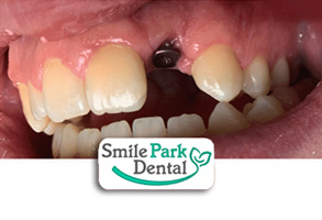 Cosmetic Dental Office in Oakville ON