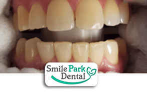 Cosmetic Dentist near Oakville ON