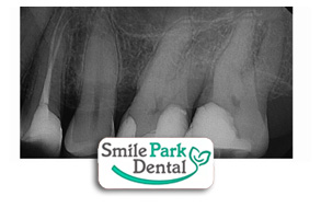 Family Dentist in Oakville ON