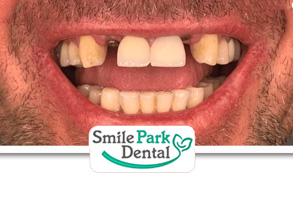 Invisalign Oakville ON