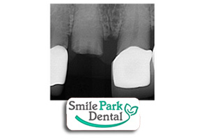 Family Dentist in Oakville ON