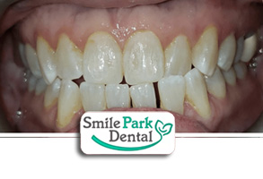 Dentist in Oakville ON