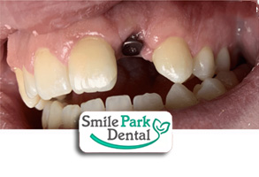 Dentist in Oakville ON