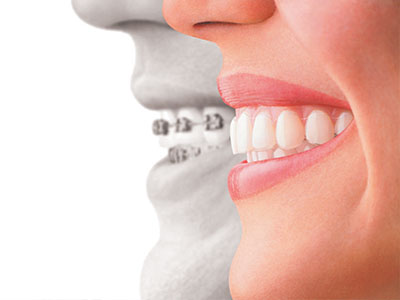 Smile Park Dental | Root Canals, Dentures and Sedation Dentistry
